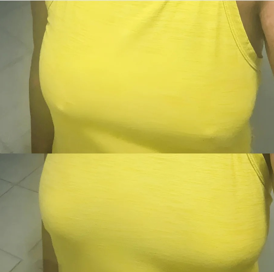 NipGrip™ – Cubiertas sin costuras