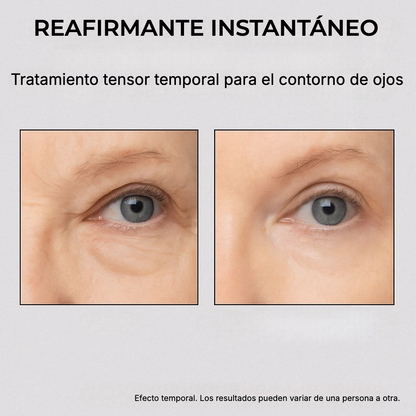 Tratamiento Reafirmante Instantáneo para los Ojos